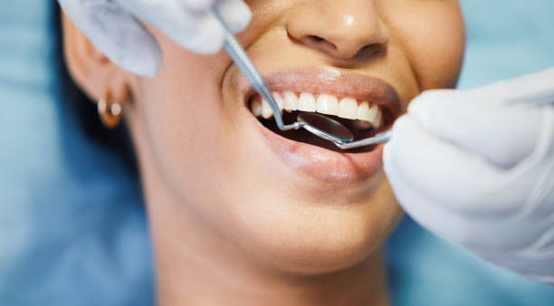 Best Emergency Wisdom Teeth Removal in Collinsville, OK