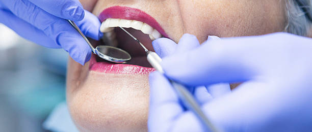 Best Emergency Tooth Extraction in Collinsville, OK