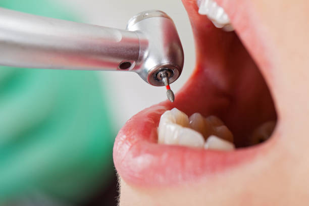 Best Emergency Denture Repair in Collinsville, OK